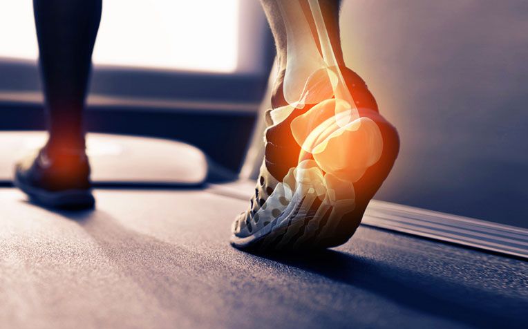 Is Heel Pain getting you down? 67 Is Heel Pain getting you down?