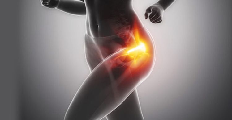 Prevention and treatment of Lateral Hip Pain