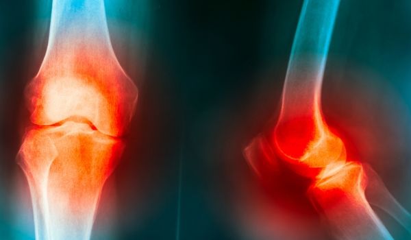 Knee and joint pain management in Sydney