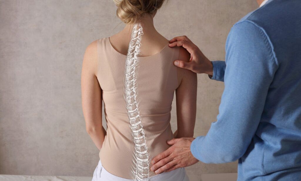 X-ray showing a spine with scoliosis curvature